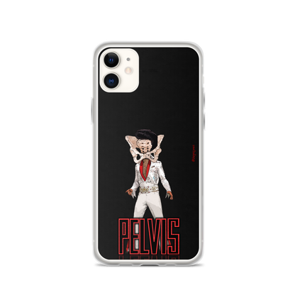 Pelvis: iPhone Case