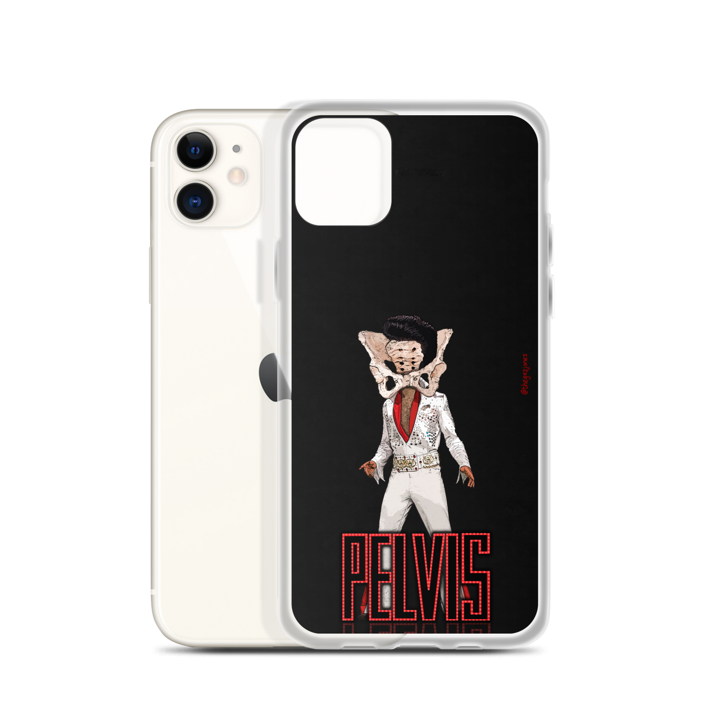 Pelvis: iPhone Case