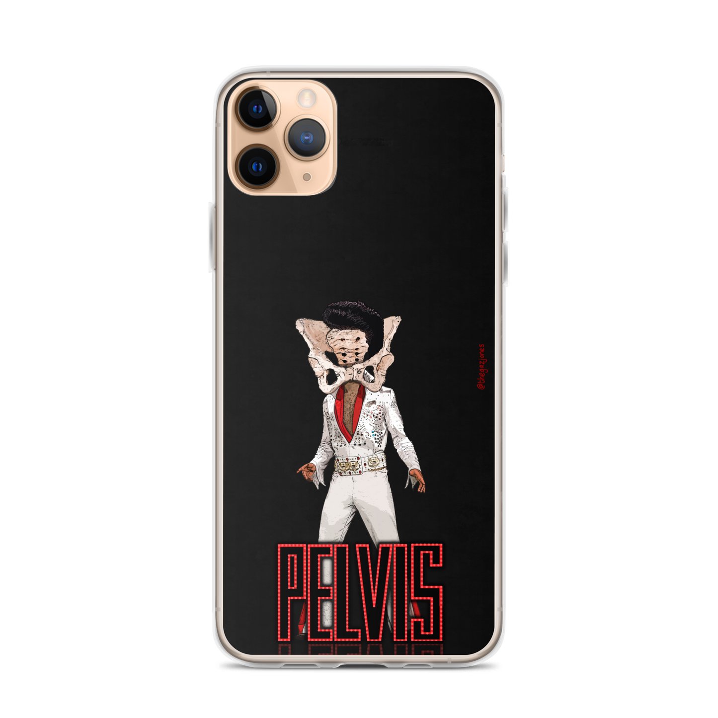 Pelvis: iPhone Case