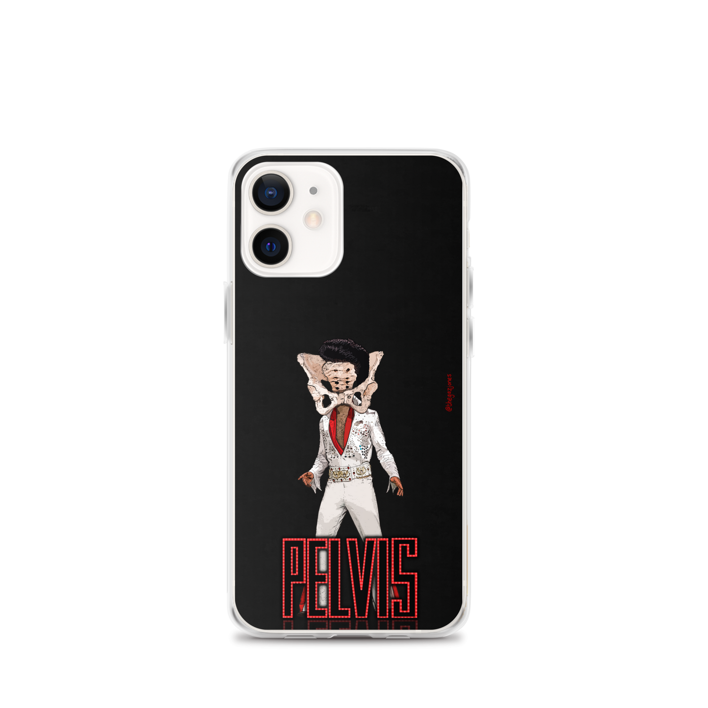 Pelvis: iPhone Case