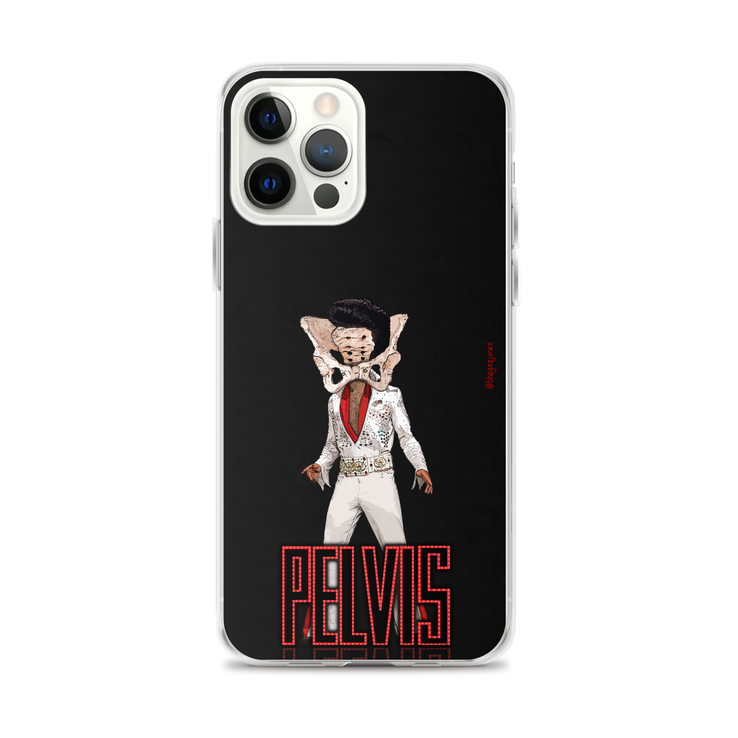 Pelvis: iPhone Case