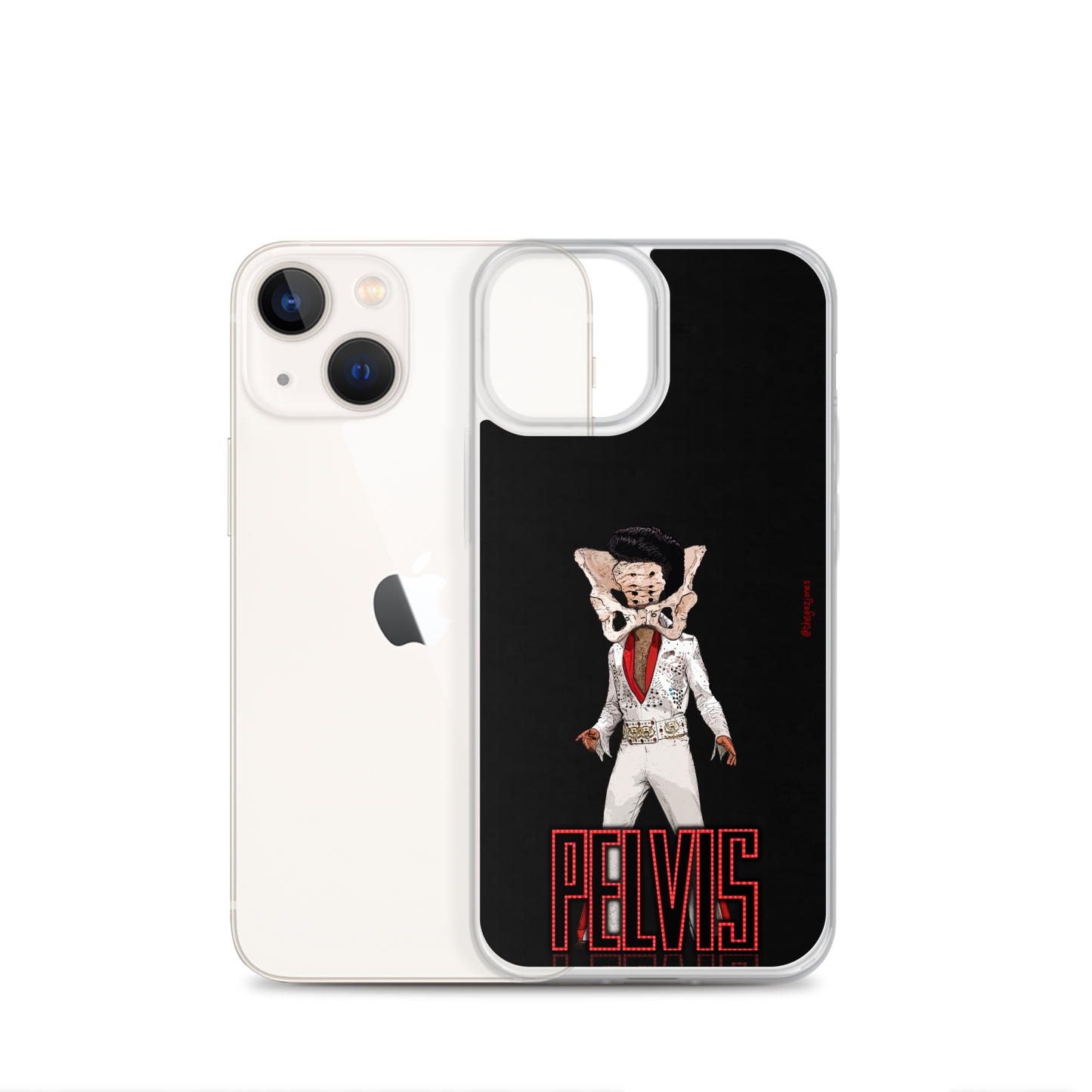 Pelvis: iPhone Case