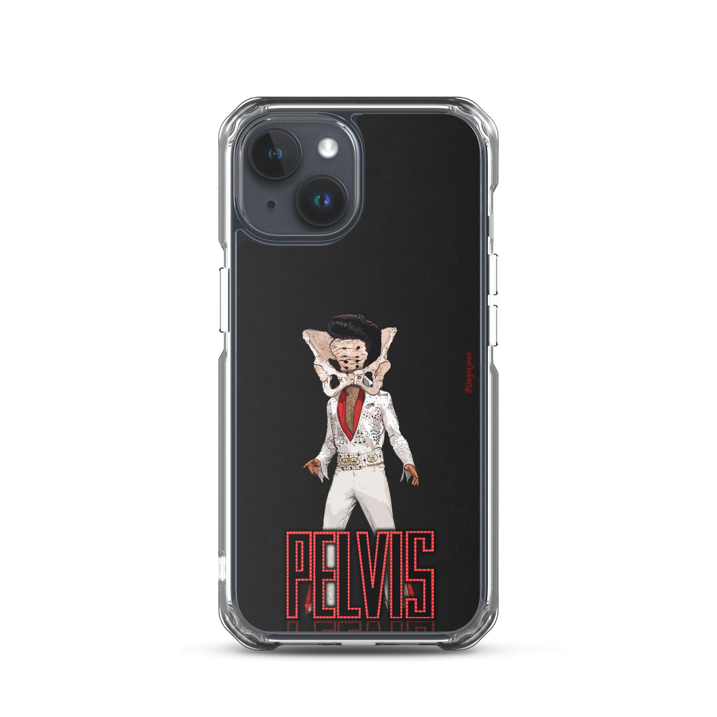 Pelvis: iPhone Case