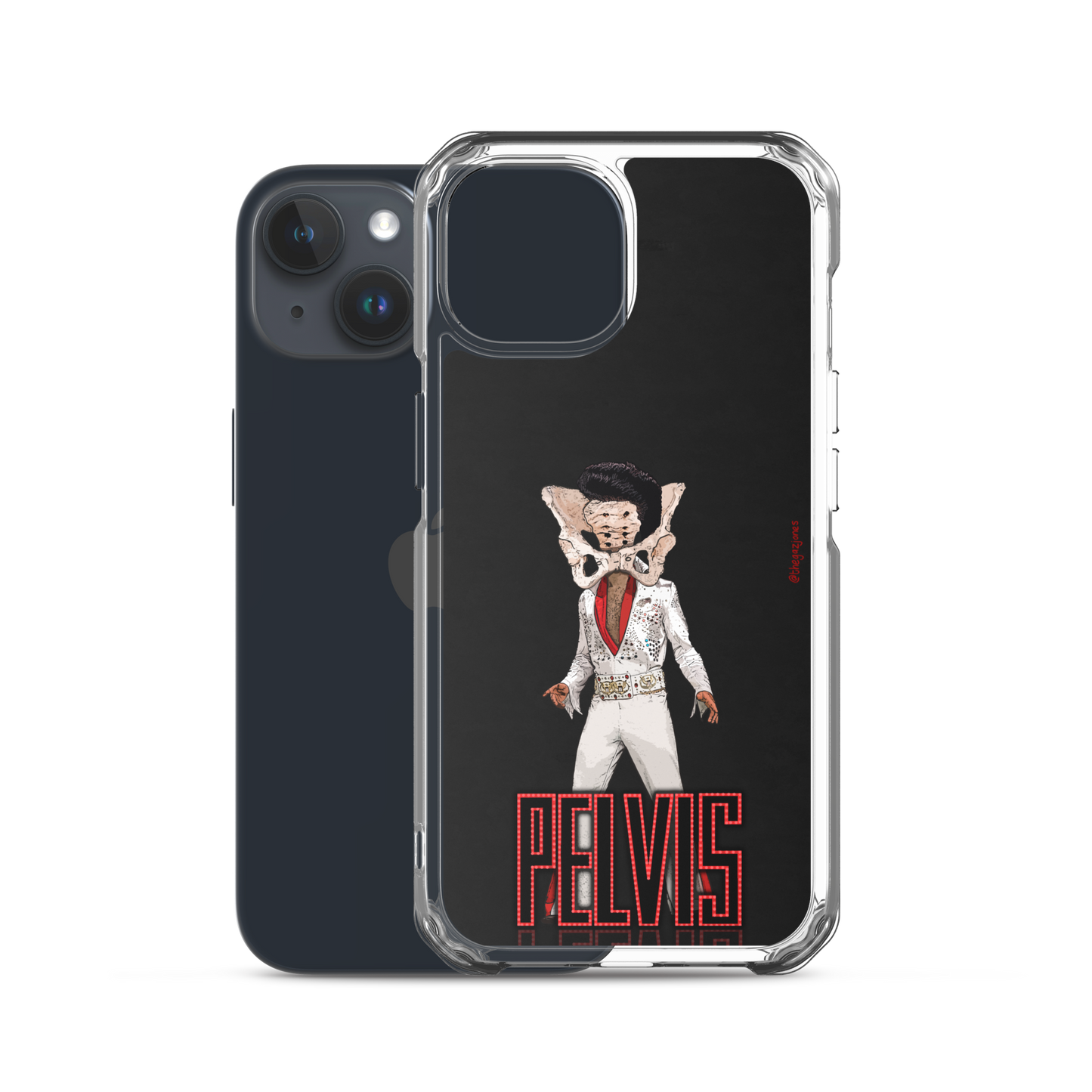 Pelvis: iPhone Case