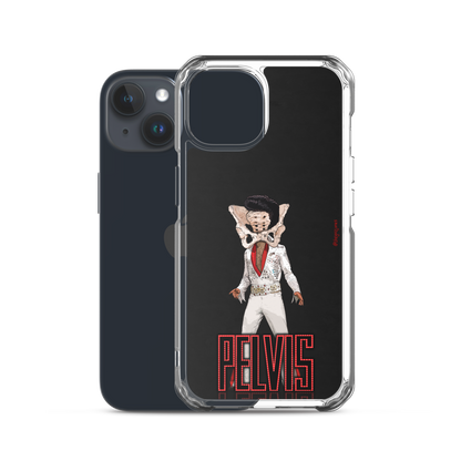 Pelvis: iPhone Case