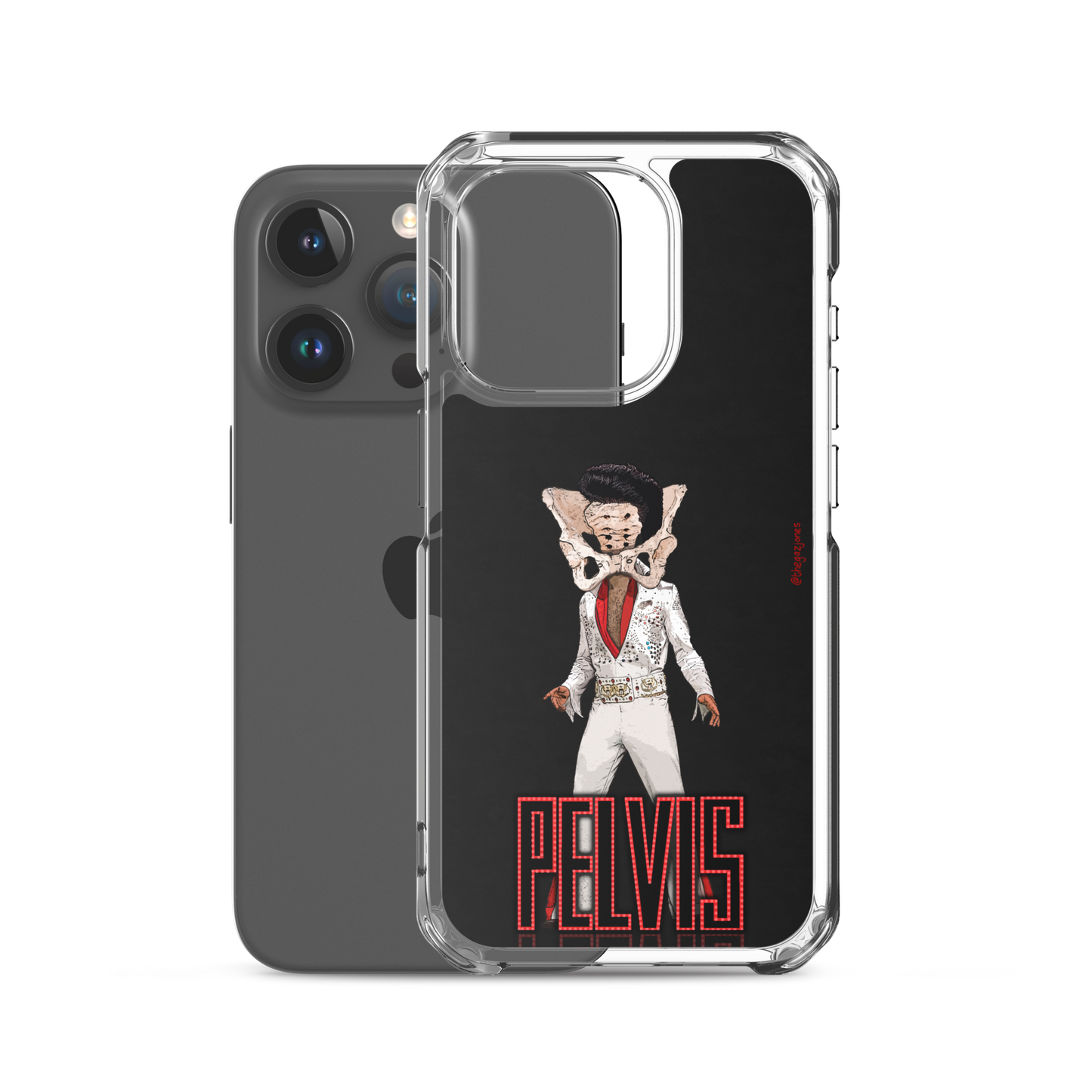 Pelvis: iPhone Case