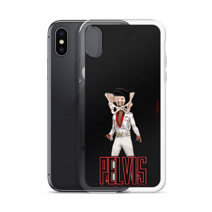 Pelvis: iPhone Case