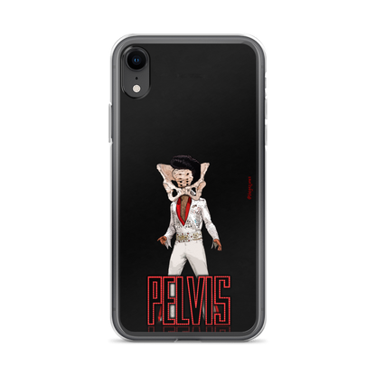 Pelvis: iPhone Case