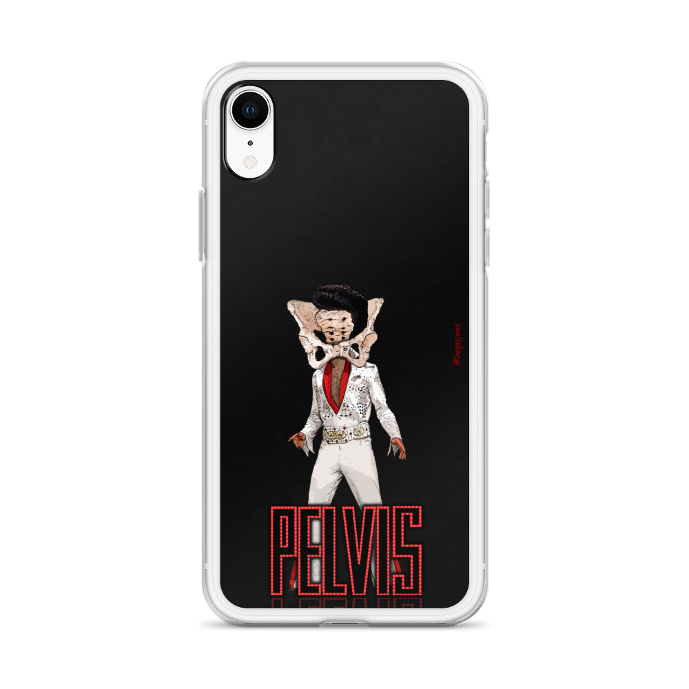 Pelvis: iPhone Case