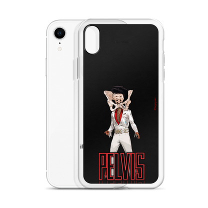 Pelvis: iPhone Case