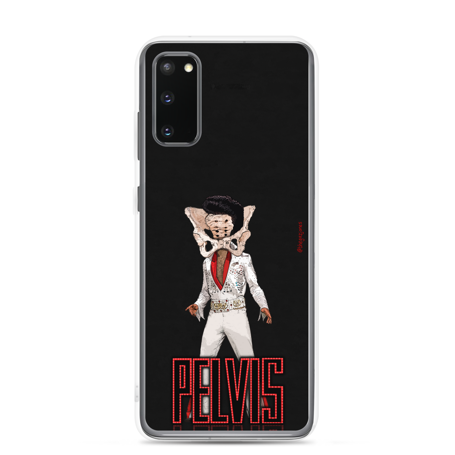 Pelvis: Samsung Case