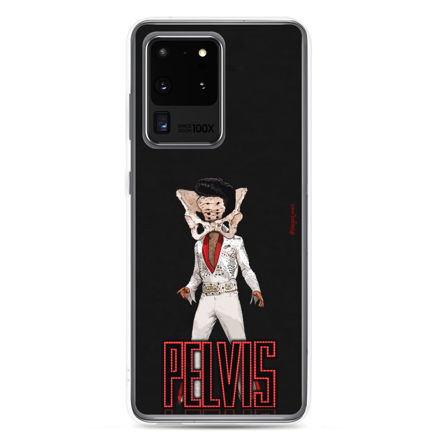 Pelvis: Samsung Case