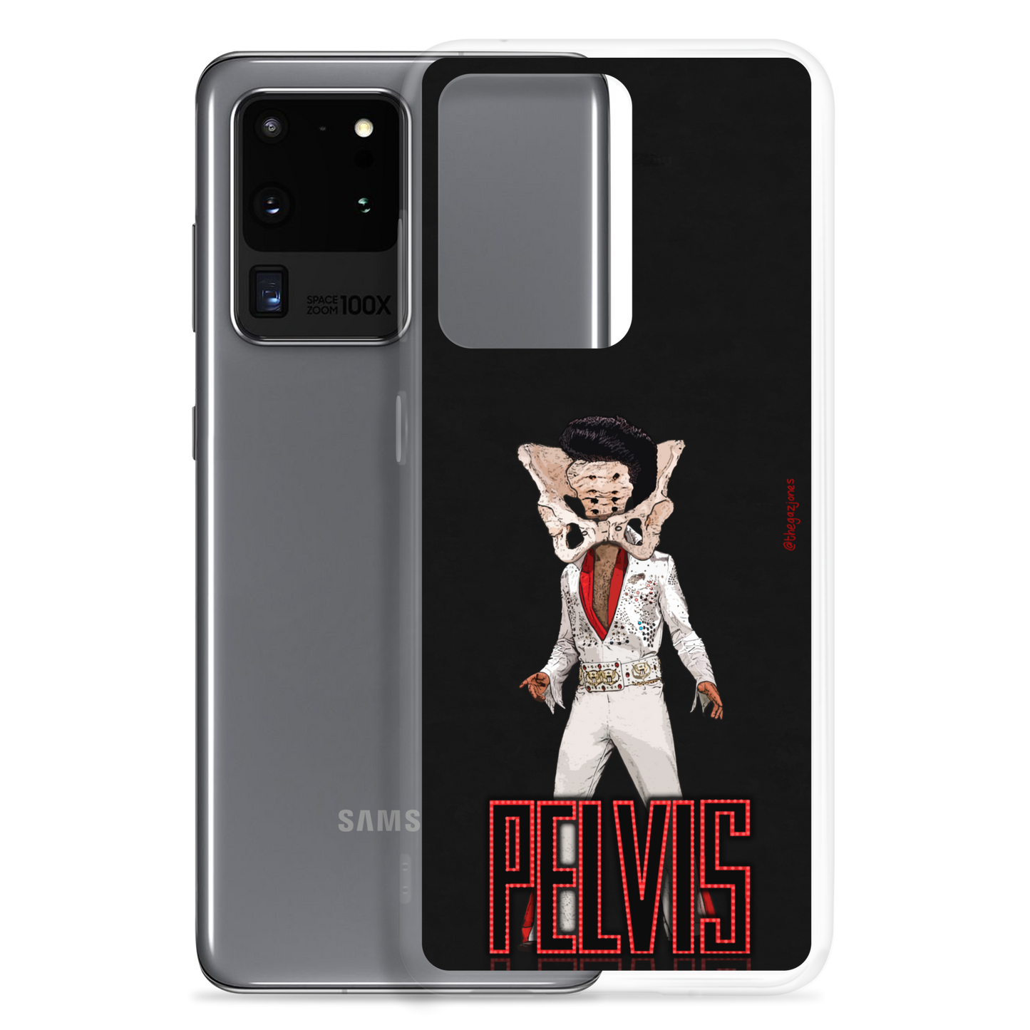 Pelvis: Samsung Case