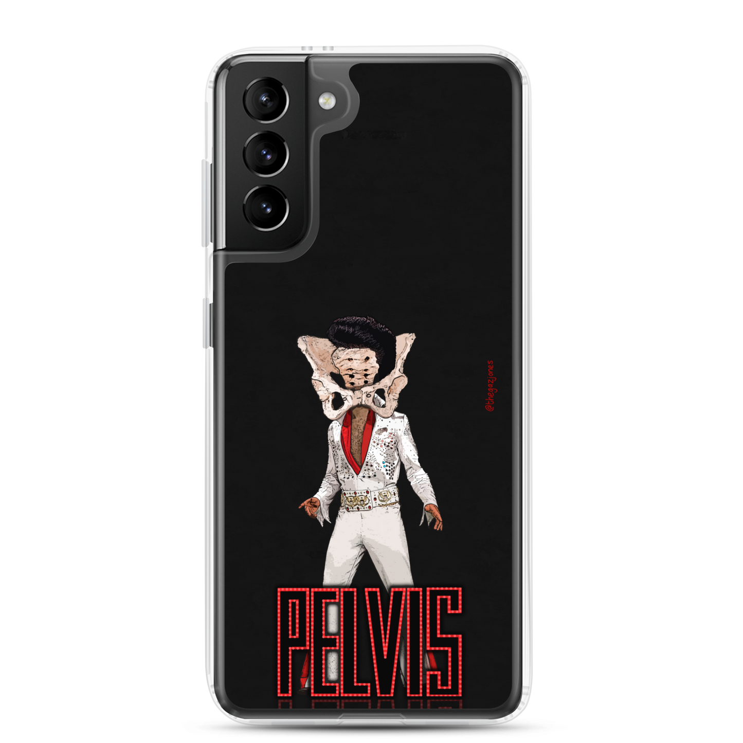 Pelvis: Samsung Case