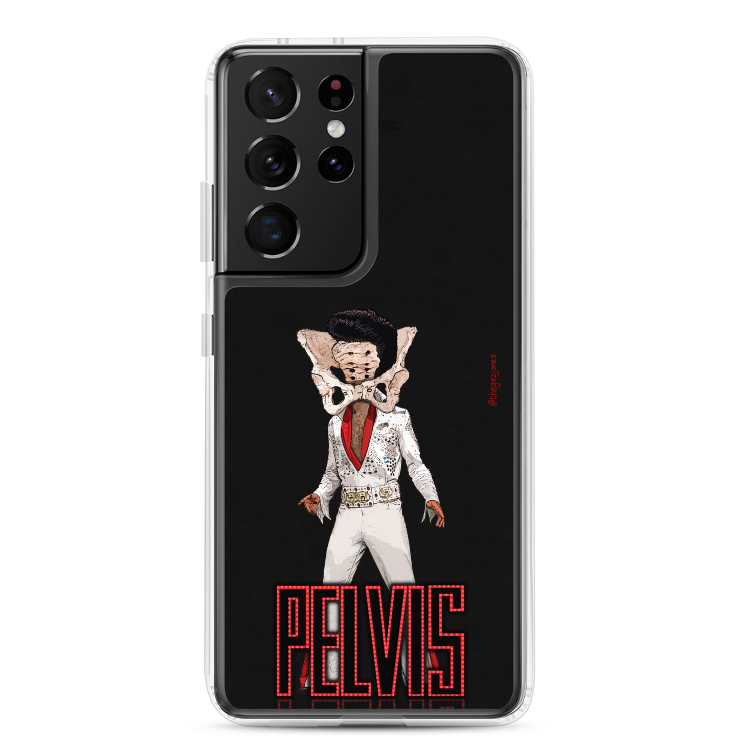 Pelvis: Samsung Case