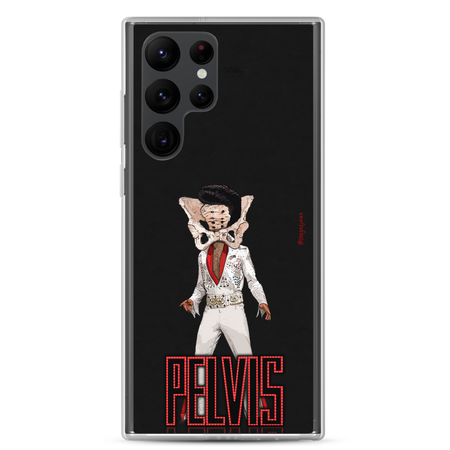 Pelvis: Samsung Case