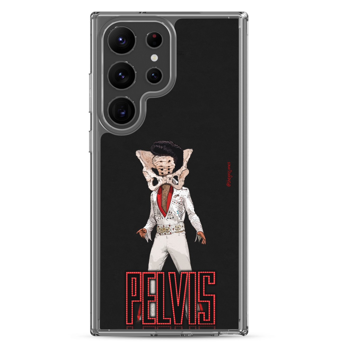 Pelvis: Samsung Case