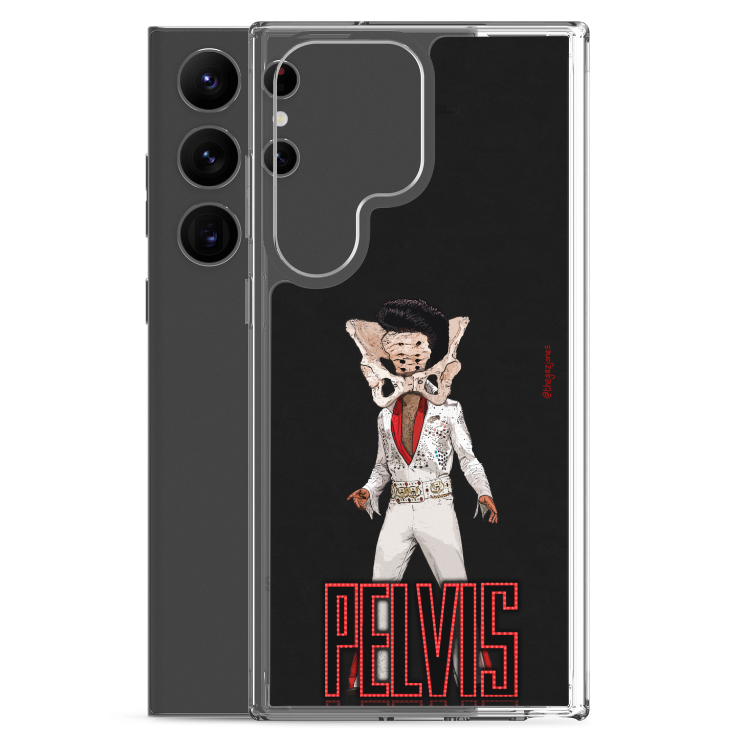 Pelvis: Samsung Case