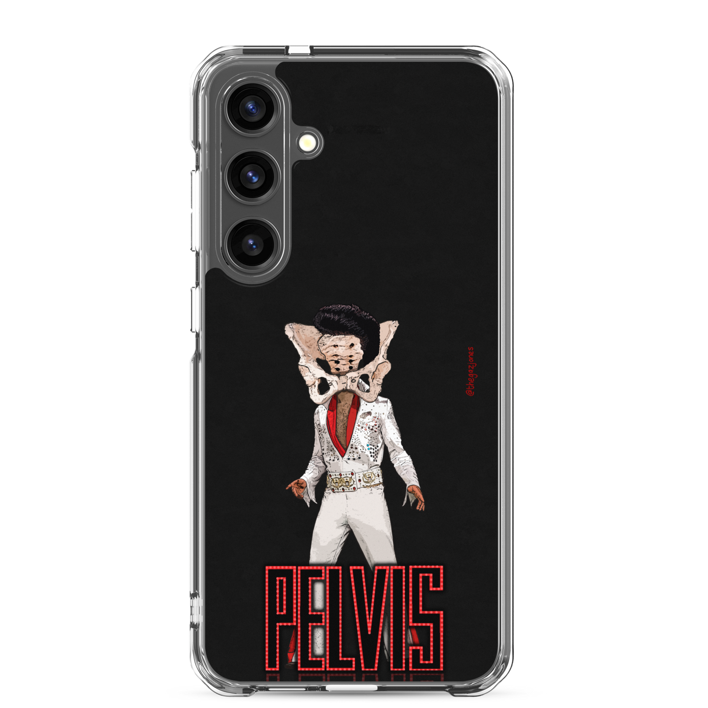 Pelvis: Samsung Case