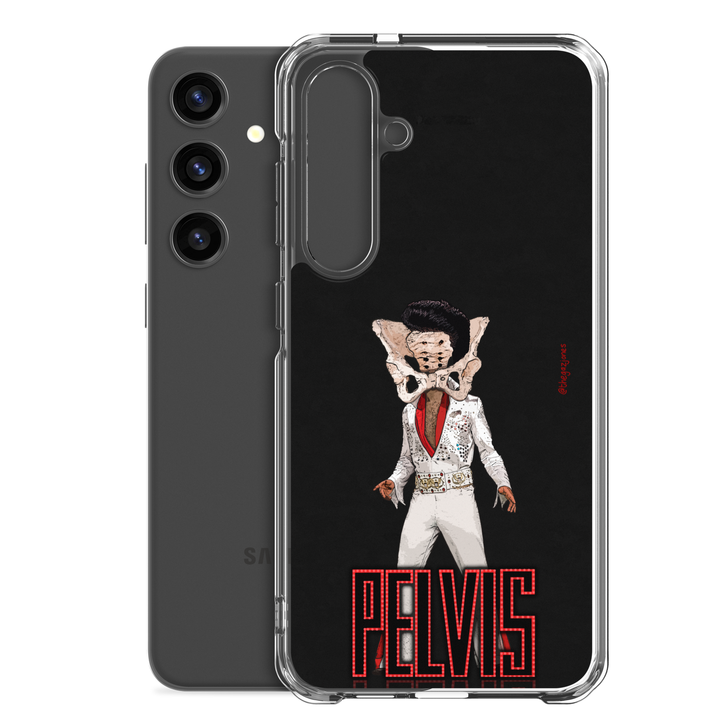 Pelvis: Samsung Case