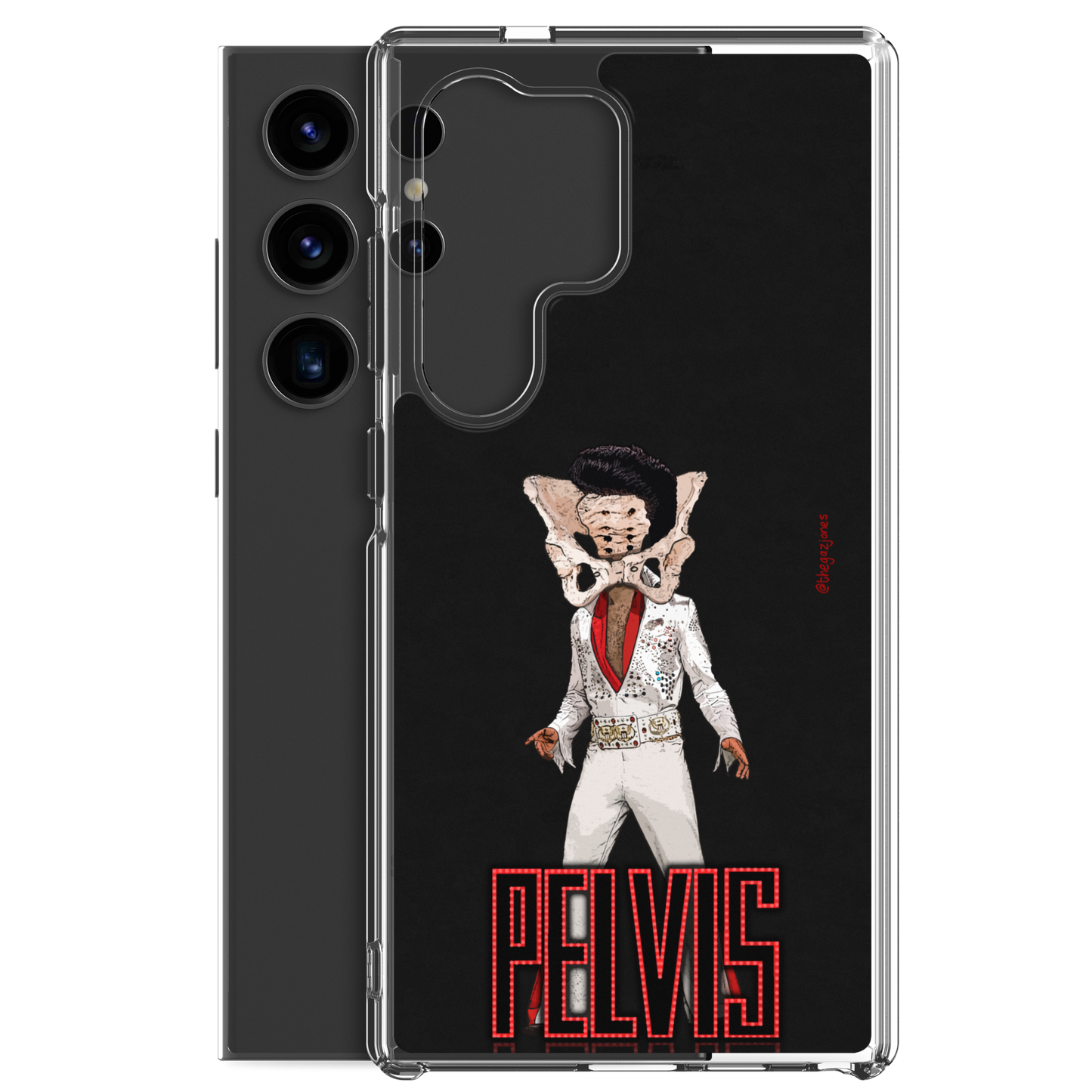 Pelvis: Samsung Case